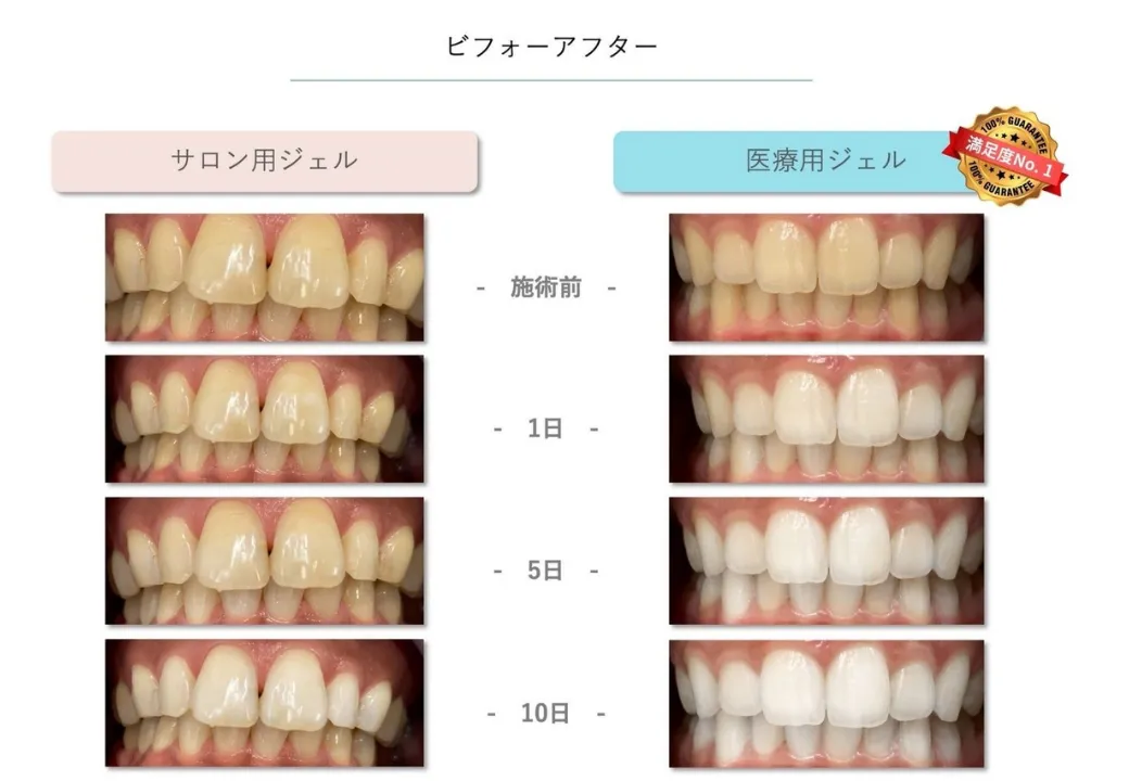 効果的な施術例