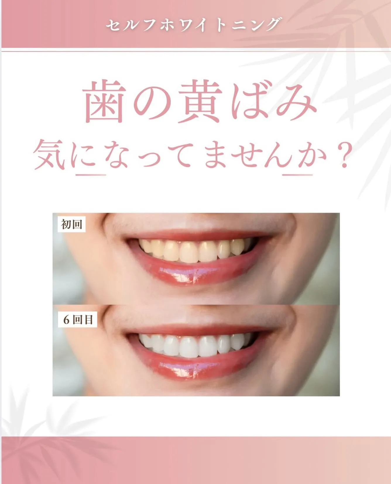 相手に与える歯の印象