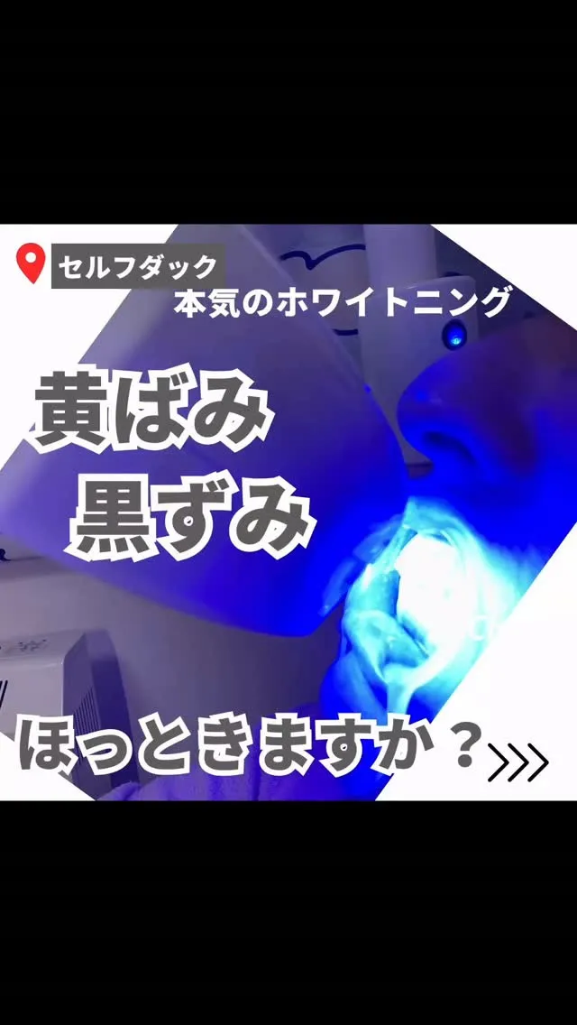 ✨本気のホワイトニング✨