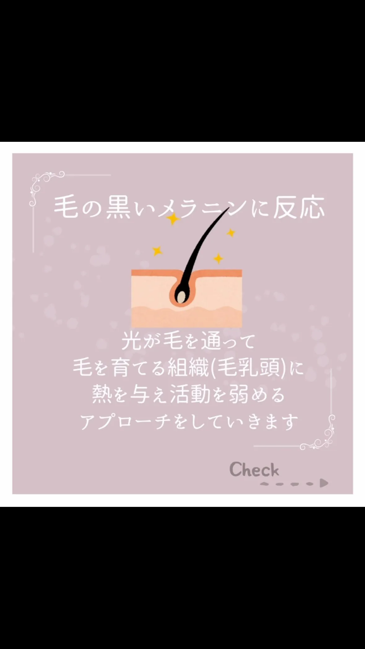 脱毛って、そもそもどういう仕組み？🤔